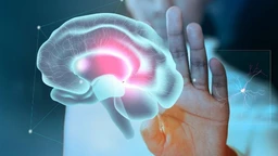 Uhvati dan: Međunarodni dan borbe protiv moždanog udara