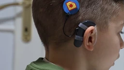 Mi možemo sve – Međunarodni dan kohlearnog implanta