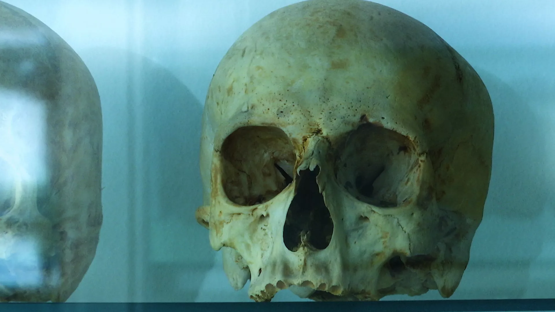 Tajne ljudskog tela: Skeletni sistem